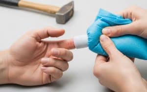Mit Hammer auf Finger geschlagen: Soforthilfe & Behandlung